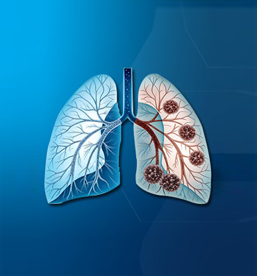 Neurology Care